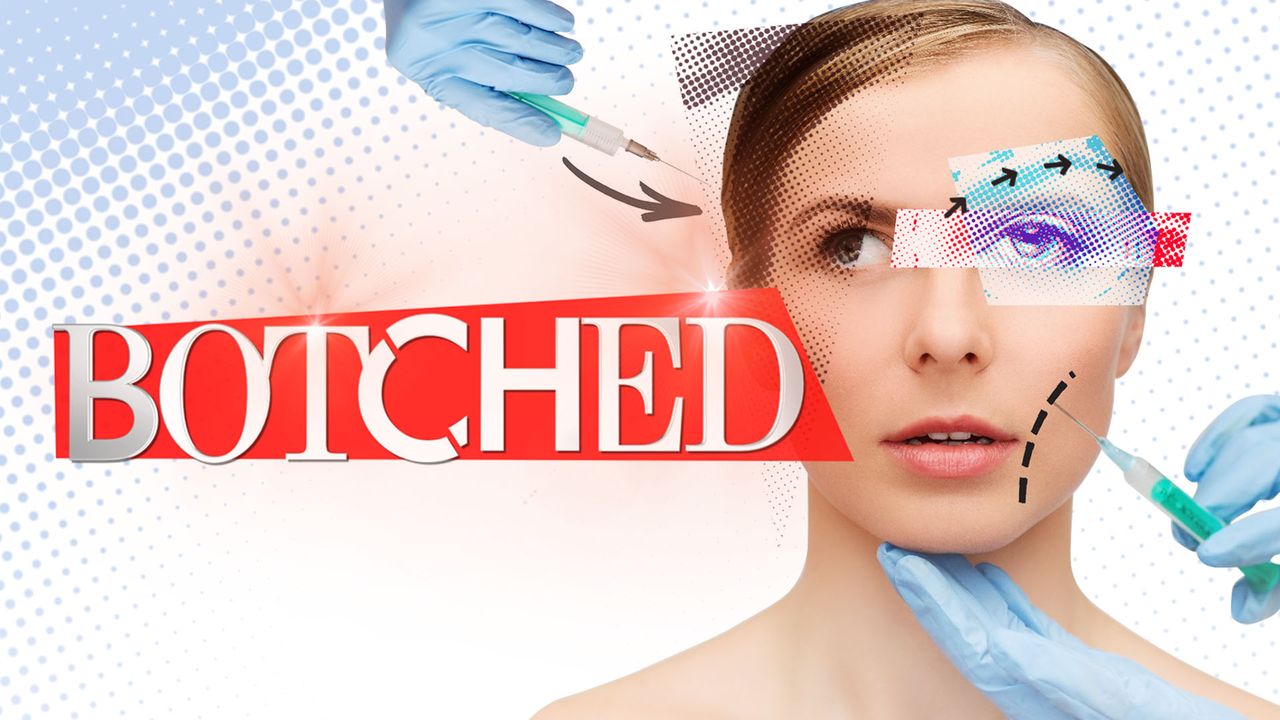 Botched - Season 7