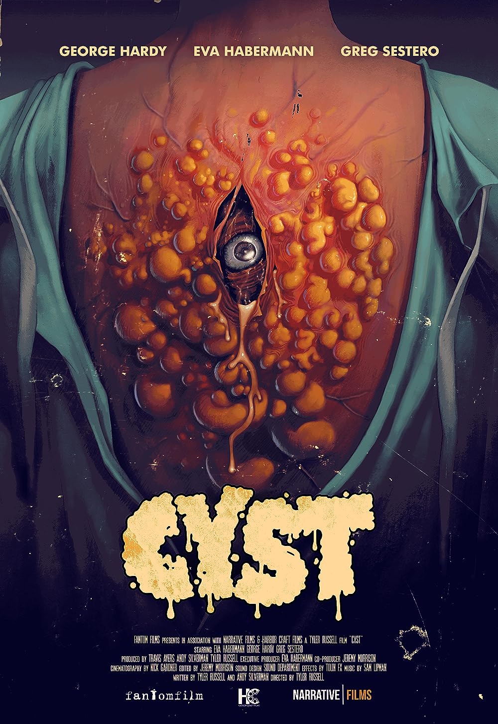 Cyst (2021)