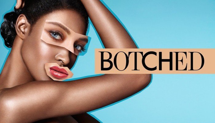 Botched - Season 4