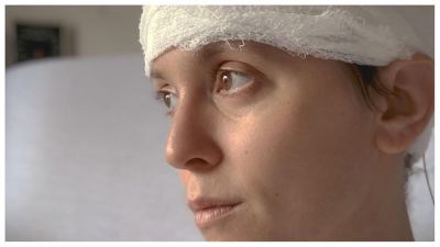 My Brain: After the Rupture (2025)